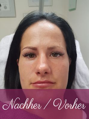Augenbraue nach Permanent Make-up