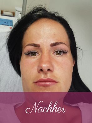 Augenbraue nach Permanent Make-up