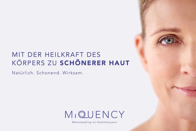 Schöne Haut durch Microneedling in Hall in Tirol