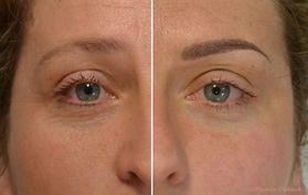 Permanent Make-Up Augenbrauen